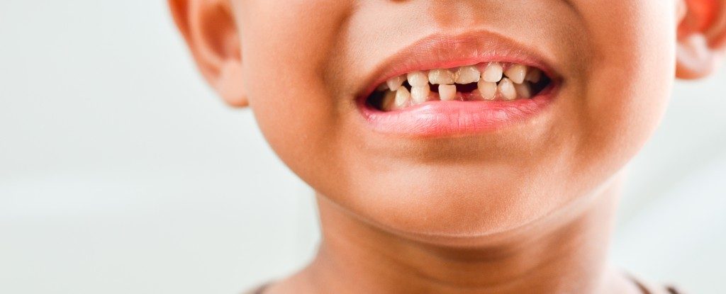 Kid smiling with missing tooth