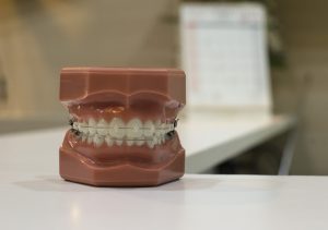 Teeth model for dental implants