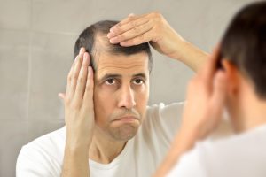 man looking at his hair loss through the mirror