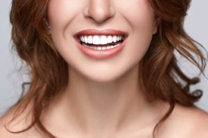 Woman with straight teeth
