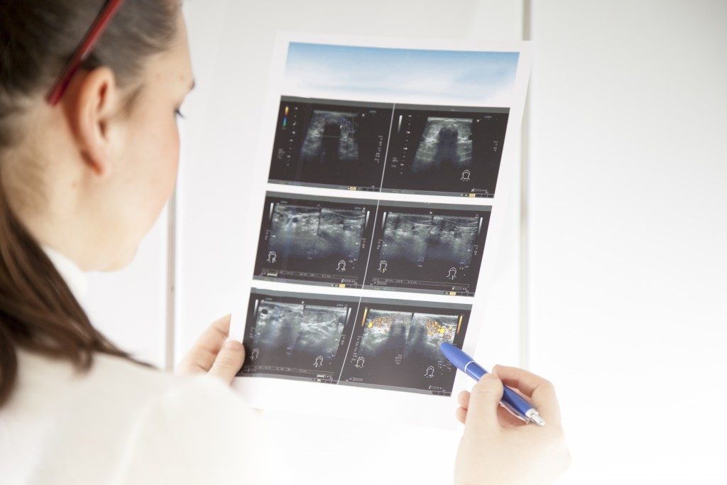 a doctor looking at a cervix ultrasound