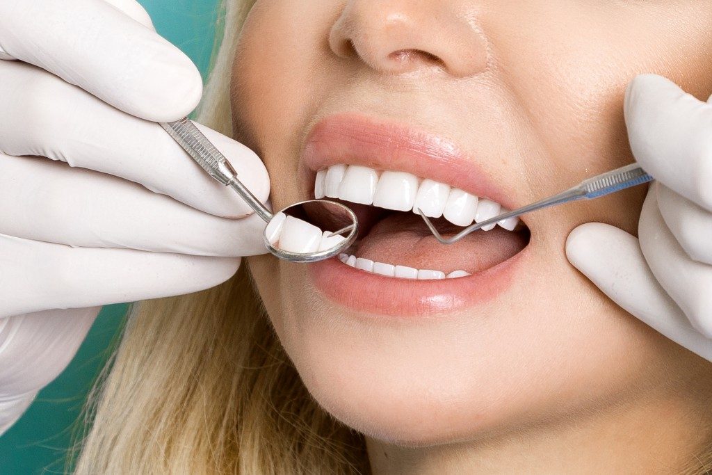 Woman with white teeth ready for procedure