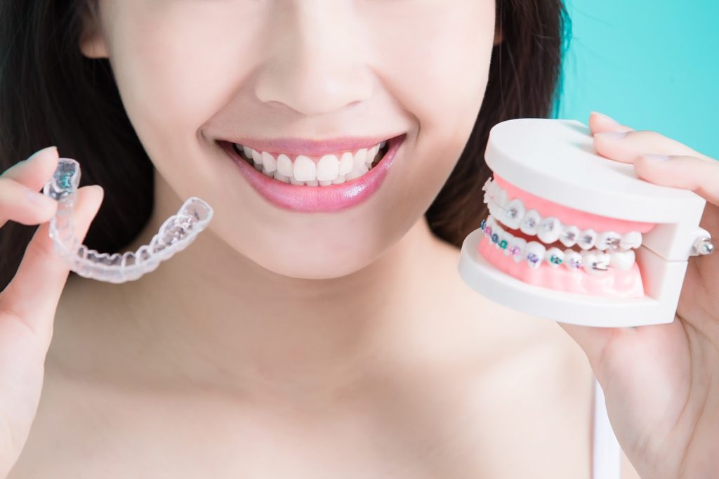 Woman holding dental braces