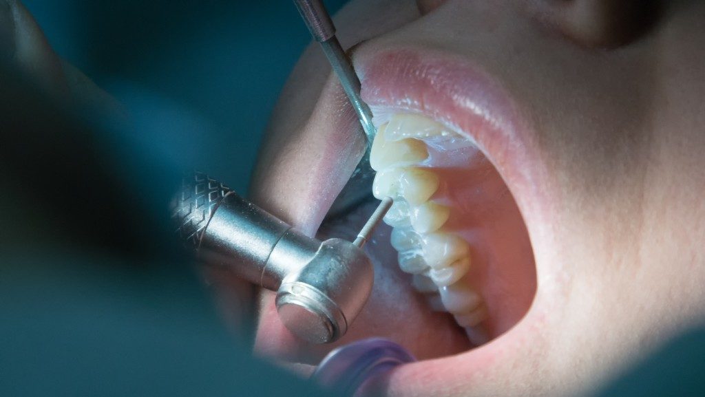 endodontic systems