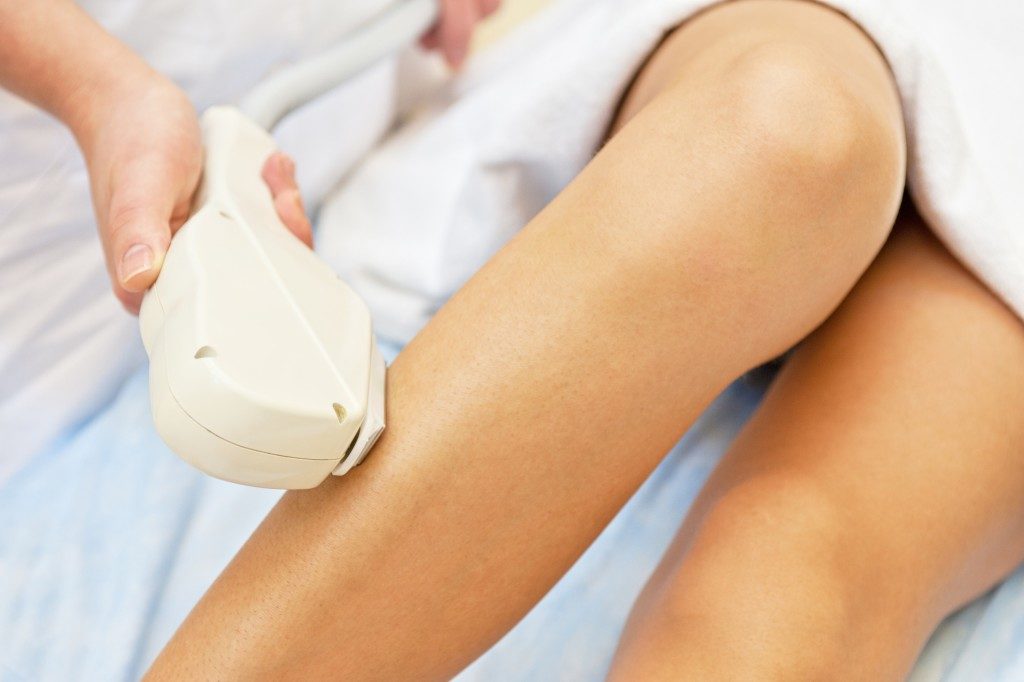 Laser hair removal on ladies legs