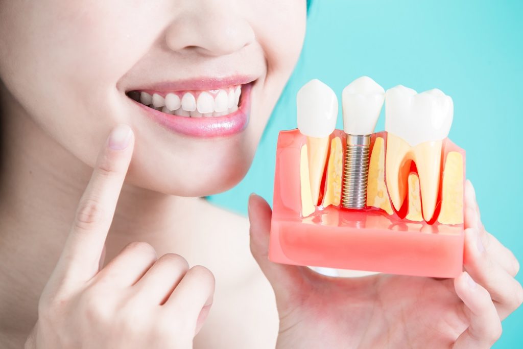 woman pointing to her teeth while holding a teeth sample model