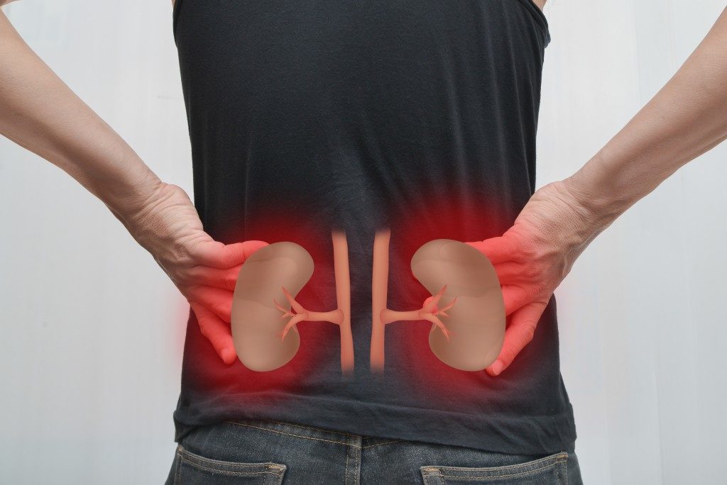 Human kidney failure