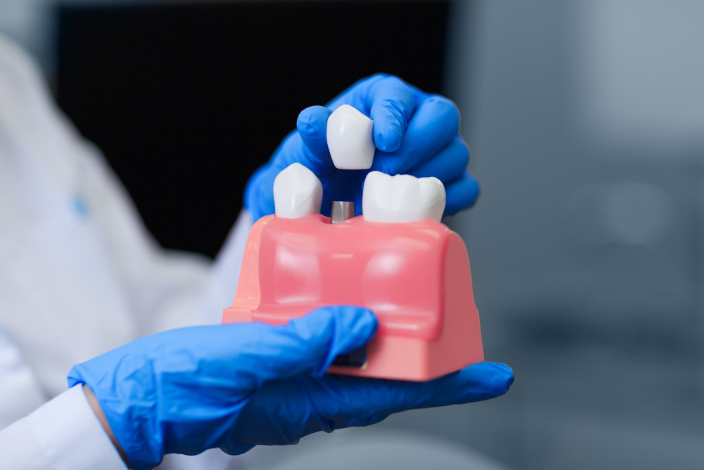 A dentist holding a model of dental implants