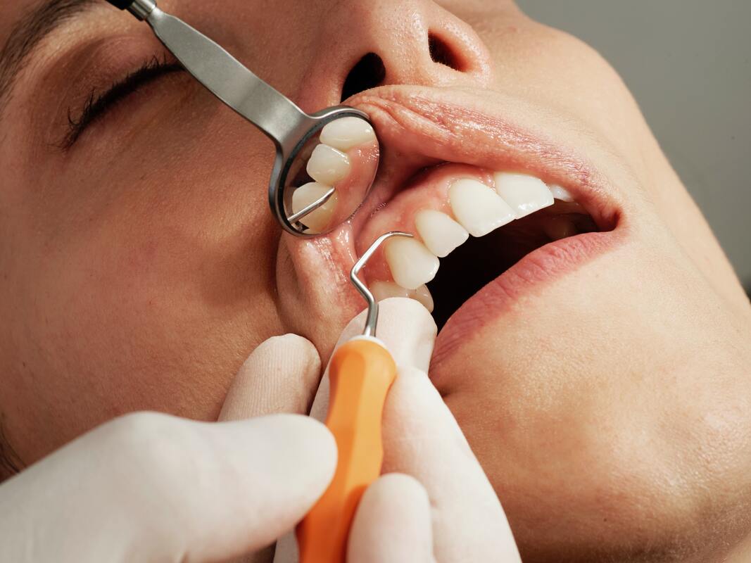 adult woman teeth being checked up