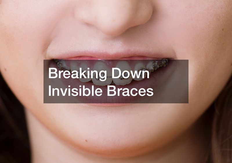 Breaking Down Invisible Braces Medical Bulletin